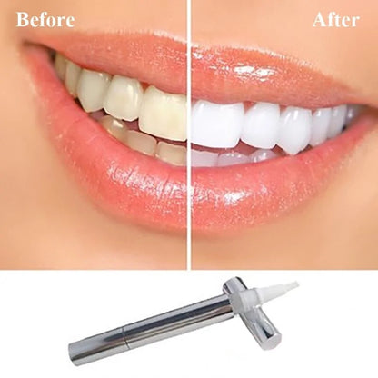 Flawless Teeth Whitening Pen